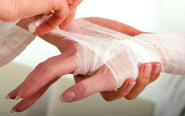 Чому лікарі не рекомендують "припікати" рани йодом: правда, яку мало хто знає