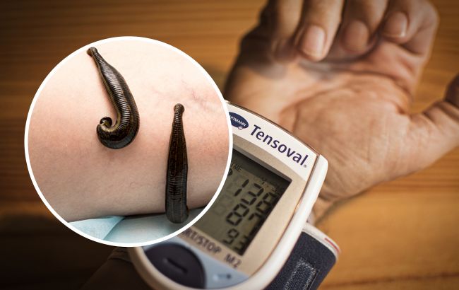 Так сбивать высокое давление нельзя: какие бабушкины способы не стоит использовать и почему