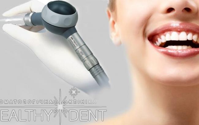 Як часто можна робити чистку зубів: думка експертів