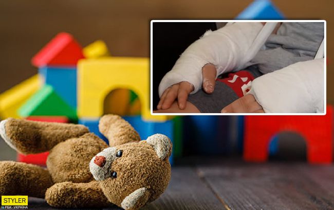 Ребенок сломал в детсаду обе руки: родители винят во всем политическую агитацию
