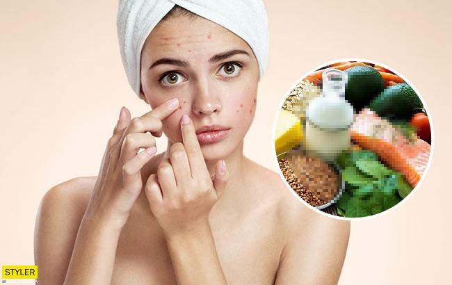 Топ-5 продуктов, которые помогут избавиться от прыщей