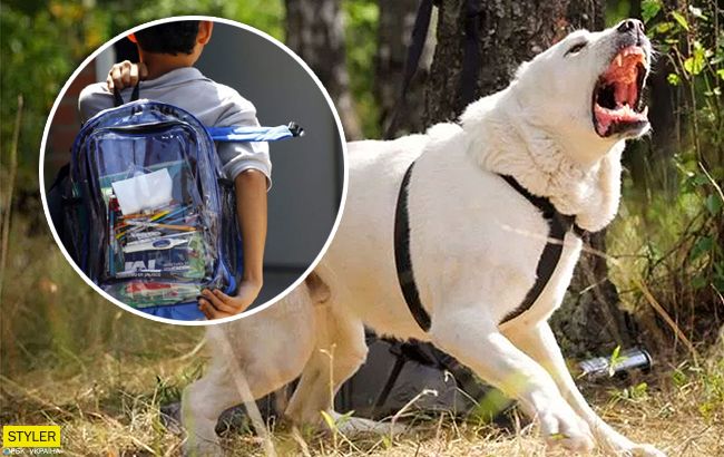 В Одеській області на дитину накинулися собаки: усі подробиці