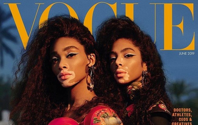 Красота в глазах смотрящего: Винни Харлоу и модель с витилиго блистают на обложке известного глянца