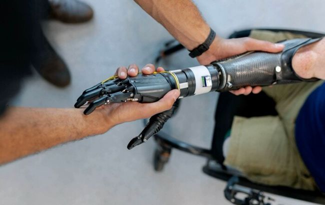 Гумпроект "Рятуємо життя" забезпечив потребу в протезуванні вже 28 українців