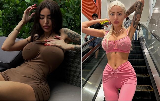 Погляньте, що сталося з "українською Кардаш'ян": знову лягла під ніж і тепер спокушає іноземців