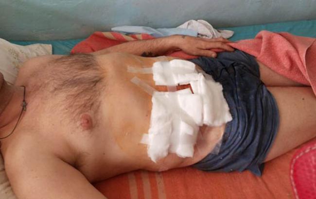 Венгрия примет на лечение 10 украинских военных