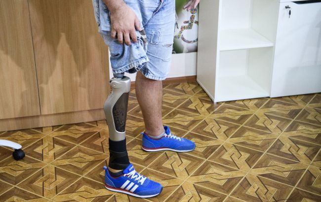 У Мінсоцполітики нагадали, як українцям безкоштовно отримати протез