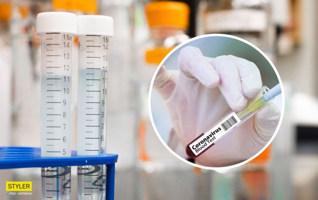 В Украине появился новый метод ПЦР-тестирования