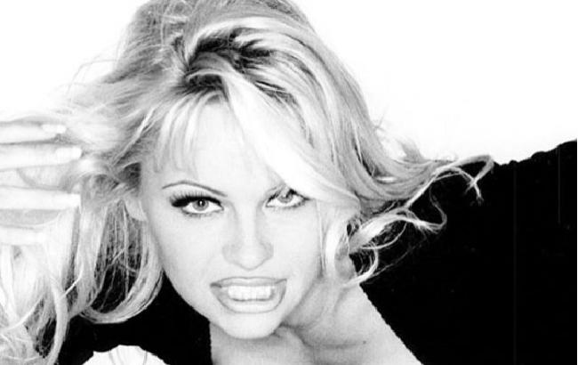 В бандаже и с костылями: Памела Андерсон испугала своих фанатов