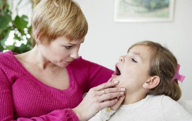 Надежные способы: как вылечить ангину без медикаментов