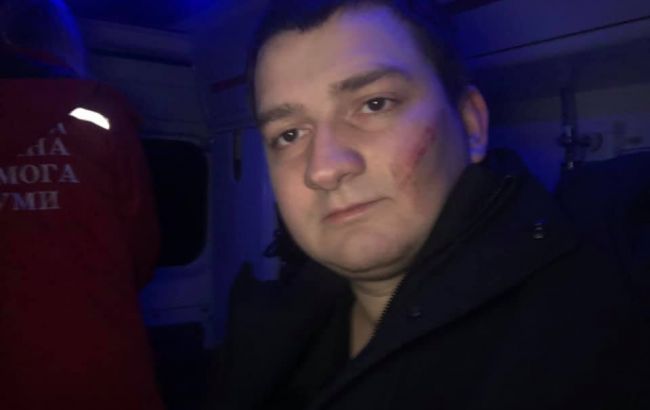 Нападение на нардепа Ананченко оказалось постановочным