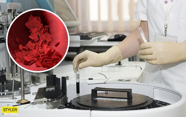 Ученые нашли новый способ уничтожать раковые клетки: все детали