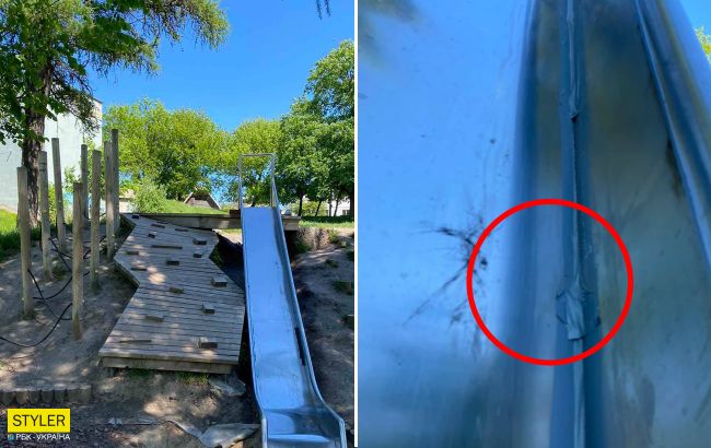 В Ровно ребенок лишился пальца после катания на горке: "сколько же можно терпеть?"