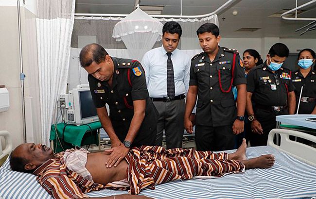 На Шрі-Ланці видалили найбільший у світі камінь з нирки вагою майже кілограм! (фото)