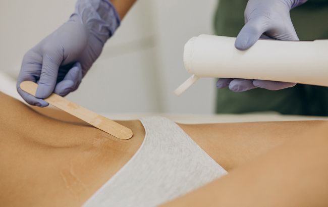 На что могут указывать "мужские" волосы у женщин: причины гирсутизма и лечение