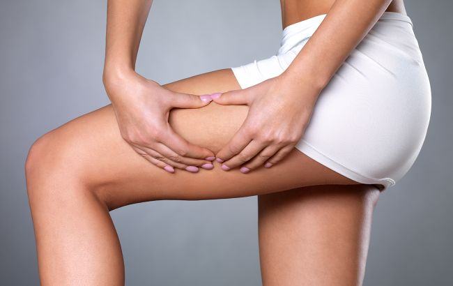 Ці 10 продуктів спричиняють целюліт та роблять на шкірі "апельсинову кірку"