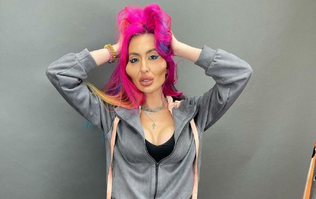 Украинка стала обладательницей самых больших скул в мире: наколола их сама