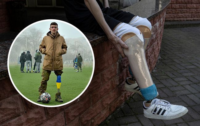 "Хочу бути на рівних". Військовий ЗСУ розповів про труднощі життя з протезом та реакцію оточення (фото)