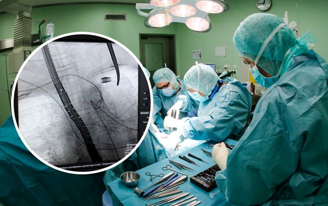 В Украине провели уникальные операции на сердце, которые делают только в лучших клиниках мира