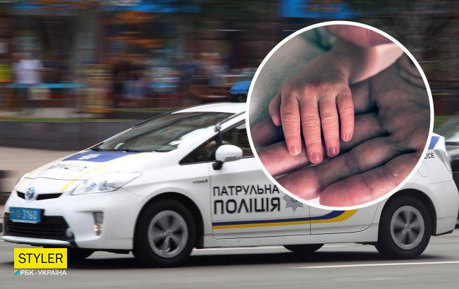 Українські патрульні допомогли врятувати життя хлопчика, який задихався