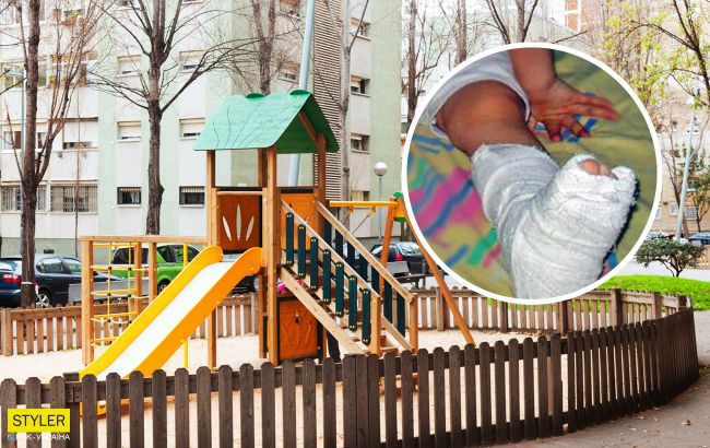 Дитину зі зламаною ногою відправили додому: у дитсадку під Запоріжжям розгорівся скандал
