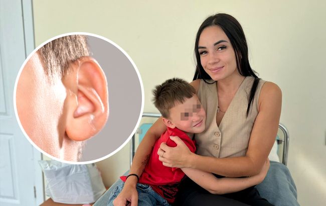 У Львові хлопчику отримав нову барабанну перетинку унікальним методом: деталі операції