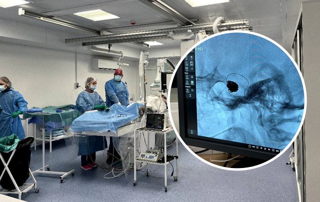 Ні одного розрізу: українські медики врятували життя жінці з величезною аневризмою