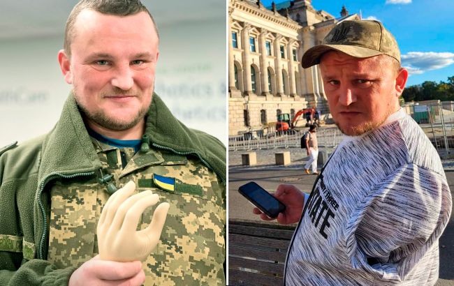 "Доводиться просити, щоб поступилися місцем". Воїн ЗСУ - про життя з протезом, реакцію суспільства і що тримає на плаву