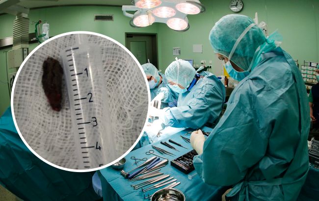 Такі операції у світі одиничні: у Дніпрі ювелірно дістали уламок з серця військового