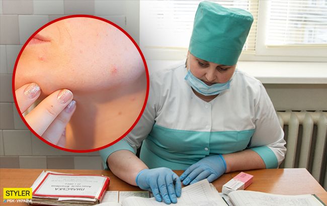 Може викликати рак: лікарі назвали небезпечне хронічне запалення