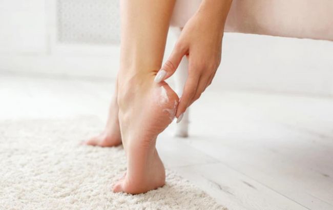 Як "реанімувати" п'яти з тріщинами вдома: лікар поділилася секретами