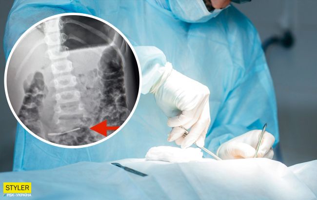 В Харькове ребенок проглотил ложку: что сделали врачи