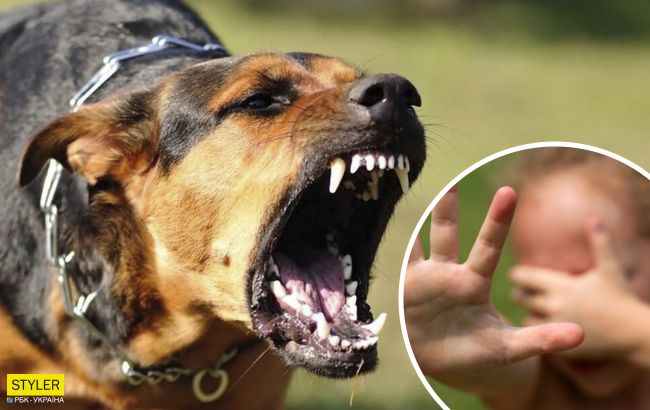 В Черкассах в реанимацию с жуткими травмами попал внук&nbsp;владельцев "питомника" собак