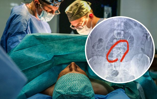 Боец ВСУ три недели воевал со сломанным хребтом. Врачи были шокированы