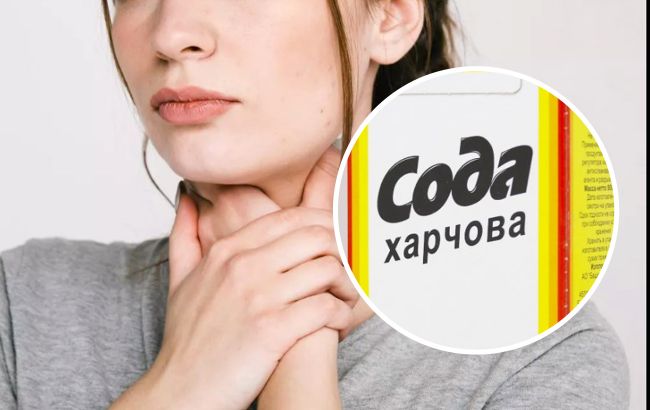 Чи можна печію "гасити" содою? Експерт здивував відповіддю