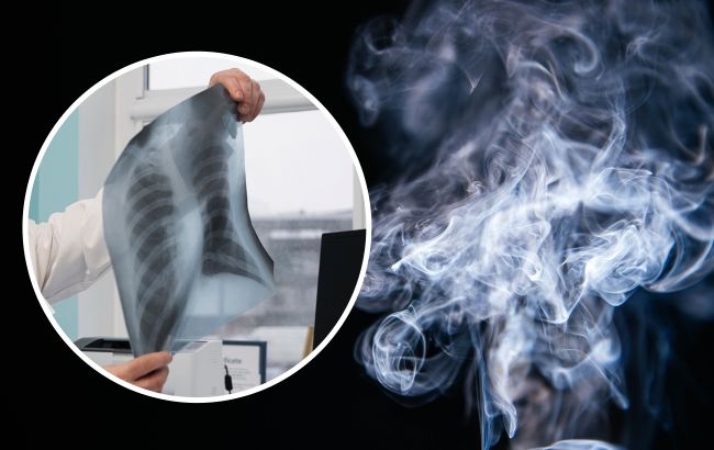 Нове дослідження показало, якими наслідками для здоров'я може обернутись куріння вейпів