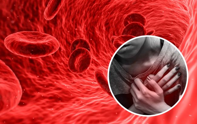 Відмова від паління та візит до лікаря. Українцям розказали, як зменшити ризик хвороб серця