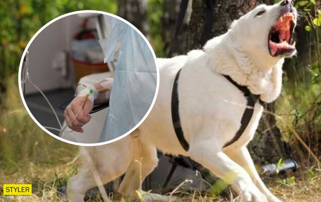 В Херсоне на ребенка напал домашний алабай: девочка потеряла много крови