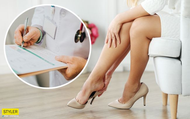 Недостаток или бомба замедленного действия? Чем на самом деле грозит варикоз