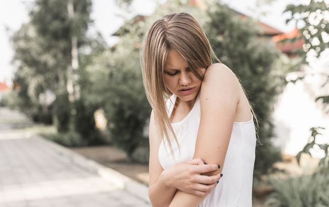 Виявляється, цих жінок частіше кусають комарі: заява вчених