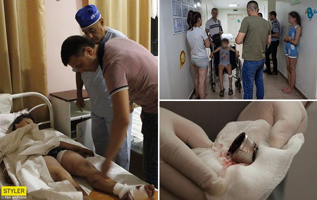 Взрыв на детской площадке под Днепром: появилась новая информация о покалеченных детях