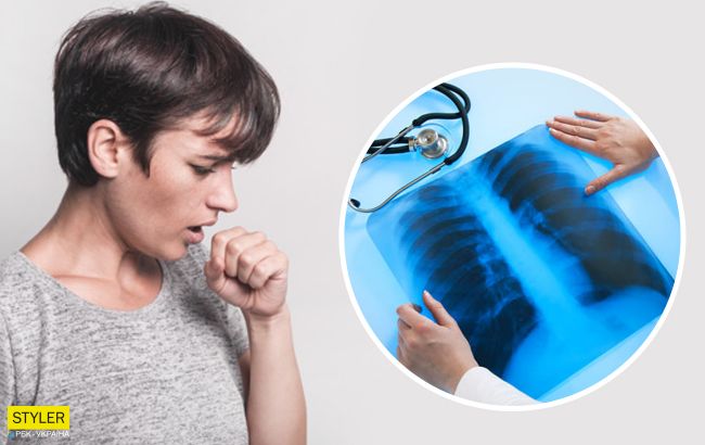 Как отличить пневмонию от простуды: самый верный способ