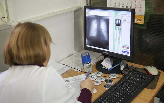 В Киеве до конца августа можно бесплатно пройти флюорографию