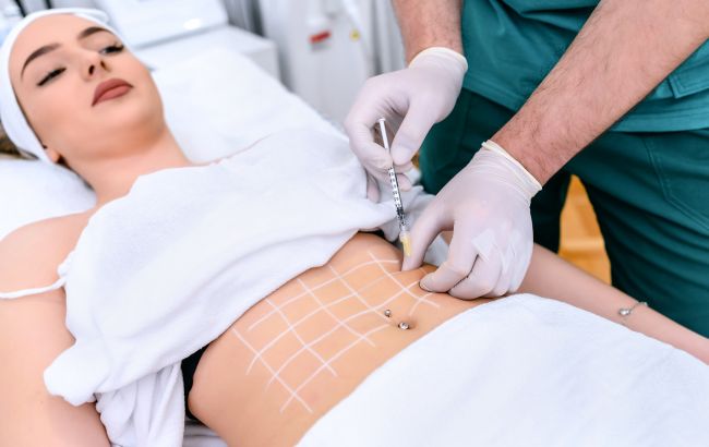 "Ліпосакція - не метод швидкого схуднення": як роблять цю операцію і кому вона насправді потрібна