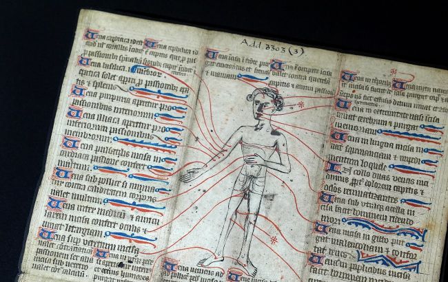 Самый отвратительный ритуал в истории. Как английские короли "исцеляли" больных