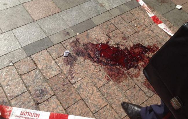 В больницах остаются 55 раненых под Радой нацгвардейцев