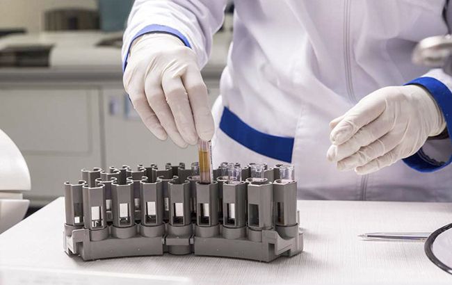 Викинуті гроші: лікарі назвали топ-10 непотрібних аналізів