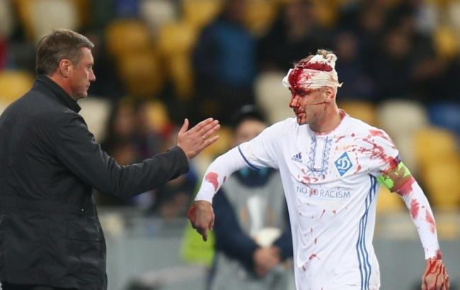 Вида пропустит матч с "Шахтером"