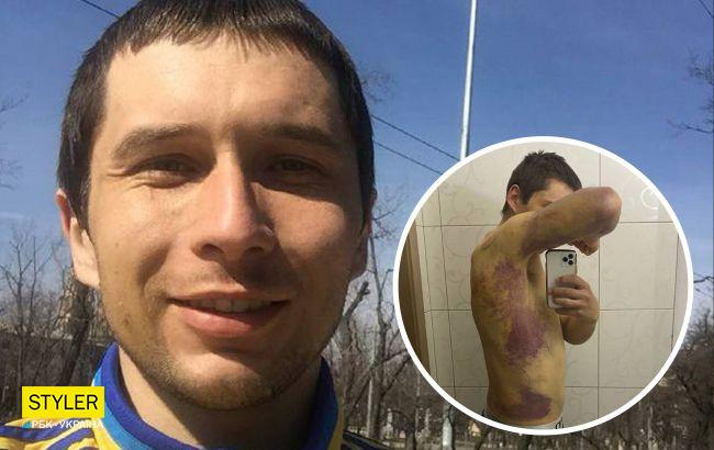 Украинец из-под Харькова попал в плен и смог выбраться: "я единственный, кто вырвался"