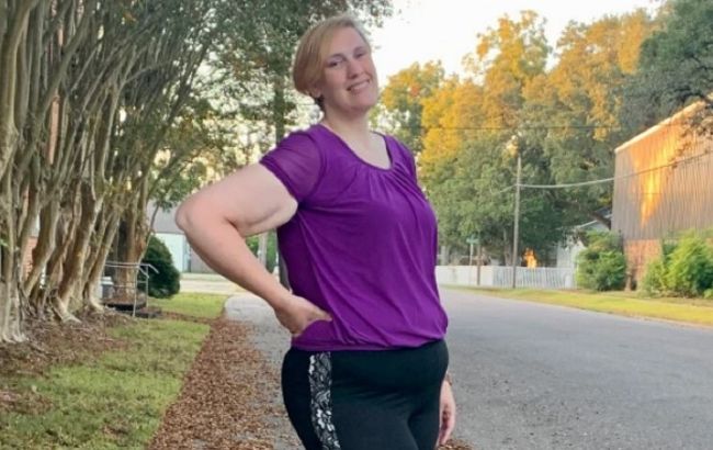 Смотрите, как выглядит женщина с самым большим размером ноги. За ее фото готовы платить